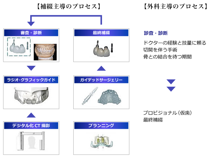 補綴主導のインプラント治療イメージ