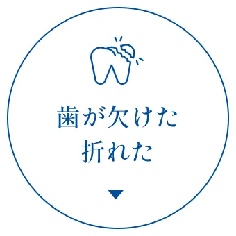 歯が欠けた・折れた
